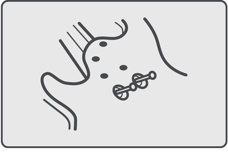 Công nghệ Miter Bolting